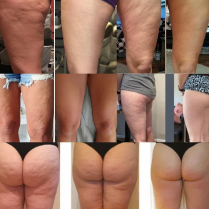 LumiLymph™ Lymphatic Drainage Roller